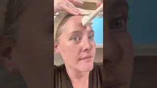 Adjustable Derma Stamp: The Ultimate Microneedling Skincare Tool! #microneedling #skincareroutine