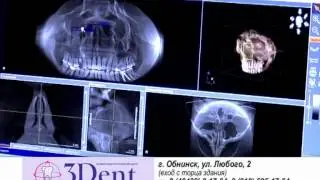 О медицинском центре 3Дент Обнинск