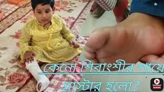 keno shivanshir paye plaster kora ? roilo akta important