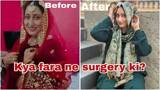 Kya Fara Ne Surgery Ki? 32kg weight loss in 5 months 