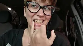 My dental bridge journey - part 2