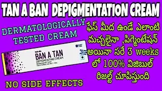 BAN A TAN DPIGMENTING cream #ban a tan review in telugu#ban a tan depigmentation cream benifits 