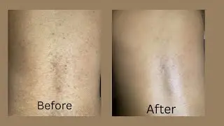 Relaxing back facial