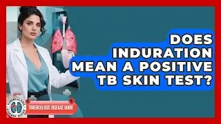 Does Induration Mean A Positive TB Skin Test? - Tuberculosis Disease Guide