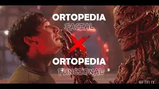 Ortopedia Facial x Ortopedia Funcional