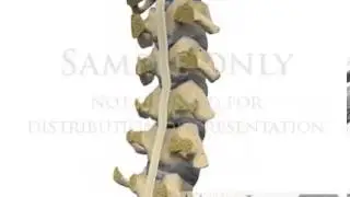 OPLL