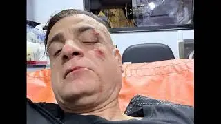Cicalone aggredito da 10 rom alla stazione di Ottaviano (Roma), poi portato via in ambulanza