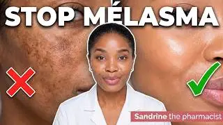 MELASMA & SPOTS: Hyperpigmentation &ndash; everything you need to know and how to treat it