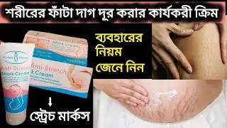 anti stretch mark cream ব্যবহারের নিয়ম | পেটের ফাটা দাগের ক্রিম/ stretch mark cream review