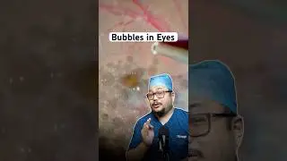 Have you ever seen Bubbles in Human Eyes? #eyehealth #facts #healthyeyes #eyecheckup