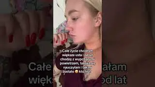 Wypchane usta powietrzem #youtubeshorts #lips