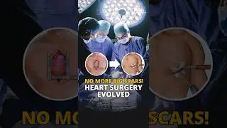 No More Big Scars! Heart Surgery Evolved | Dr. AGK Gokhale | Cardiac Surgeon