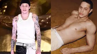 Pete Davidson Gave Another Update On The Grueling Process Of Getting His 200-Ish Tattoos Removed