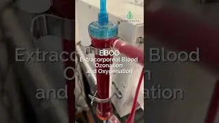Inside Our New EBOO Device | Advanced Blood Detox Treatment