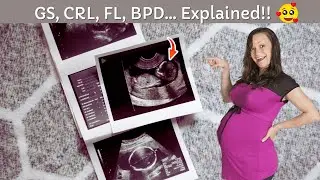 Meaning of GS, CRL, FL, BPD, HC, AC, FHR, and EFW  Pregnancy Ultrasound Report ❤️
