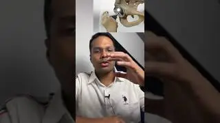 Hip pain AVN - Wrong treatment Hemireplacement surgery #hippain #shorts