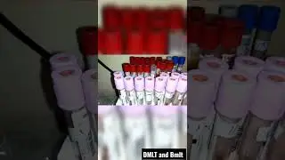 #dmlt #bmlt #pathologyboy #mlt #laboratory #status #video #like this video 💯💯❤️