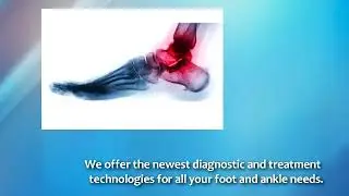 Best Heel Pain Treatment In Houston  - foothouston.com