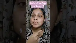 Pink Foundry Acne Spot Corrector Must try  #acnetreatment  #pinkfoundry #shorts  #ytshorts