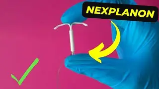 Uncovering the Benefits and Side Effects of Nexplanon Medication: What You Need to Know