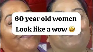 Hydra Facial #viral #hydrafacial #hydra #antiaging #glowingskin #skinlover #facial #vlogvideo