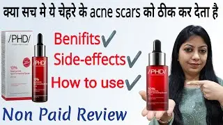PHD 10% Niacinamide Spot correcting Serum // Review @nishaAhujaThereviewgirl 