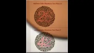 Colorblind Sunglasses Demo Simulation vs. Ishihara Dot Test (with & without Pilestone TP-006)