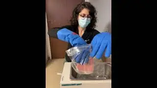 Thawing Plasma Cells