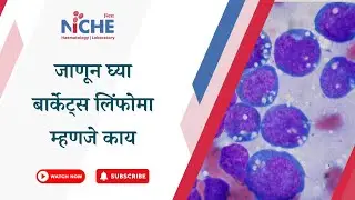 बार्केट्स लिम्फोमा म्हणजे काय ? #lymphoma #bloodcancer #thalassemia #anemia #blooddisorders