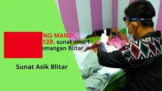 BISA LANGSUNG MANDI, 0857-2794-3128, sunat smart klamp di Kademangan Blitar