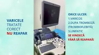 AMANAREA TRATAMENTULUI VA DUCE LA VARICE DIN CE IN CE MAI MARI CU RISCUL DE APARITIE A COMPLICATIILO