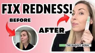 INSTANT RESULTS To Fix Redness Under $15! | The Budget Derm Reviews