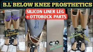 Siliconliner bilateral below knee leg #prosthetics #ottobock #artificialleg #wagnersiliconliner#leg