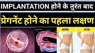 पेट में दर्द हो रहा है प्रेग्नेंसी या गैस P&euro;RIODS है तुरंत पहचाने। Early pregnancy symptoms।