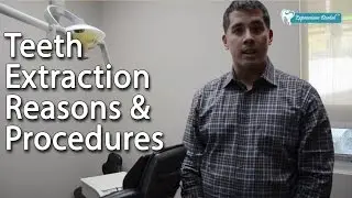 Top 3 Reasons For Teeth Extraction