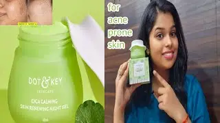 Dot and key cica and niacinamide night gel review (for acne prone skin)