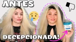 BOTOX ZERO FOREVER LISS | Deu ruim