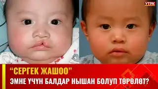 Эмне үчүн балдар нышан болуп төрөлөт? | СЕРГЕК ЖАШОО