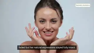 Before & After Botox in Fort Worth, TX | Smooth, Natural Results