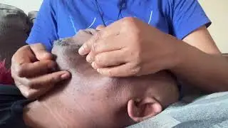 Asmr pimple pop with finger and tender face massage 