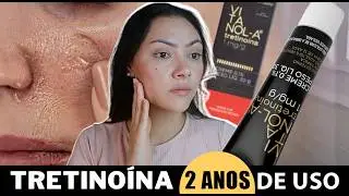 Everything about my 2 YEARS using VITANOL: MISTAKES and SUCCESSES that changed my skin 🔥 #retinol...