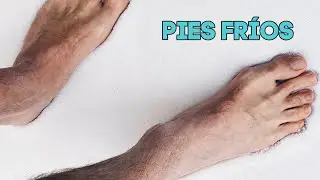 Pies Fr&iacute;o parte 1 | Causas y s&iacute;ntomas