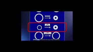 How to Diagnose Hypovolemia with TEE