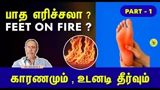 STOP பாத எரிச்சல் - காரணம், அறிகுறிகள், அதிவேக மருத்துவம். BURNING FEET. PART - 1.