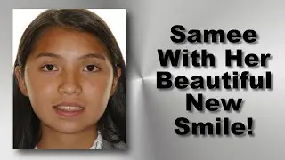 Samee Gets Her Braces Off!