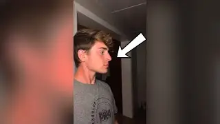 HOW TO GET A JAWLINE INSTANTLY 😳 - #shorts