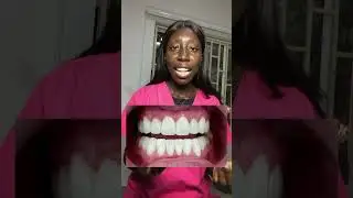 #dentist #teethwhitening #dentalclinic #missingtooth