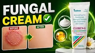 Cloben-G Cream | Cloben G cream in hindi | Cloben g antifungal | Cloben G