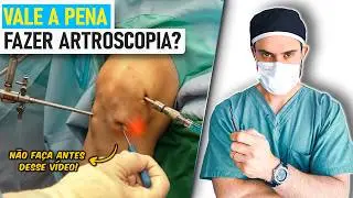 Artroscopia de Joelho: Tudo sobre! Para que Serve? Quem Deve e NÃO Deve Fazer! [Aulão c/Ortopedista]