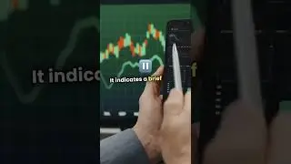 Top 5 Forex Chart Patterns You NEED to Know! 📈💰 #ForexTrading